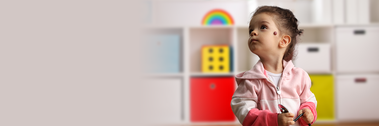 Preschooler with hemangioma on her left cheek holds her doctor's stethoscope at an office visit