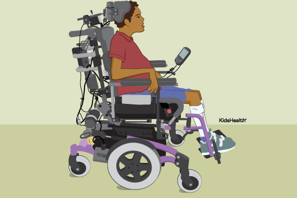Power Wheelchair