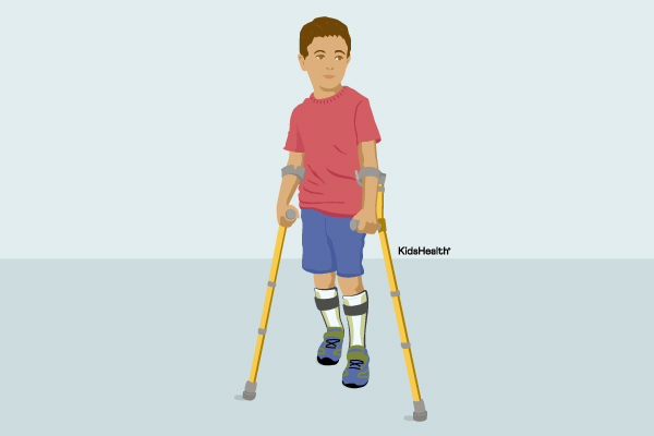 Forearm Crutches