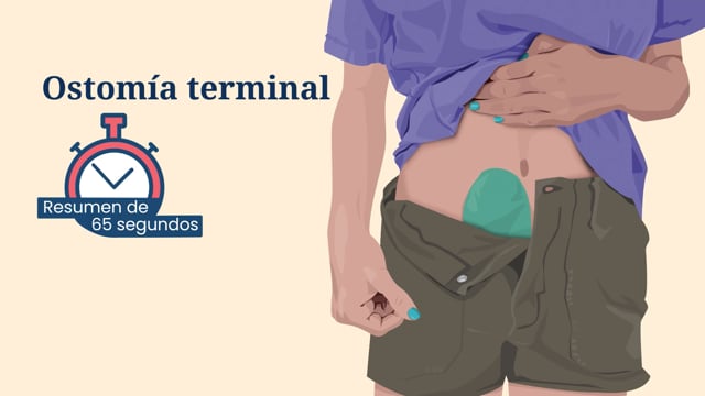 Resumen de 65 segundos: Ostomía terminal