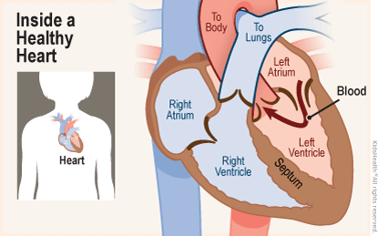 Two diagrams show the position of the heart in the body and a close-up, cross section of a healthy heart. Blood flows from the left atrium into the left ventricle and through a valve into the aorta. 